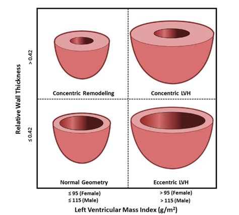 Lv wall thickness calculator